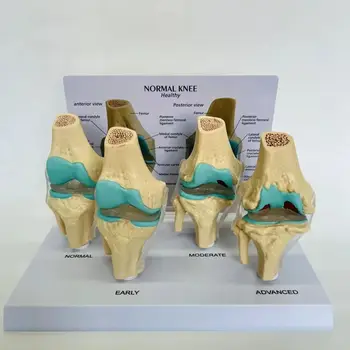1 Vnt Žmogaus Anatomija Skeletas Gyvenimo Dydis 4-Etapais Kelio Sąnario Anatomijos Modelis Mokymo Reikmenys